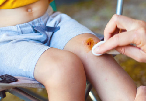 Letní úrazy dětí: 7 věcí, které byste o nich měli vědět