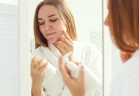 Jak jsem se zbavila akné? Můj příběh a rady dermatologa