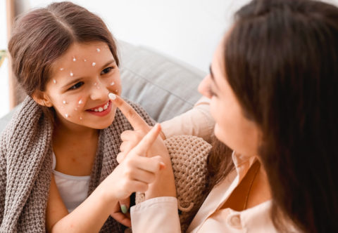 Přelom zimy a jara většinou přináší neštovice. Očkovat, nebo neočkovat? A co s nimi, když se objeví?